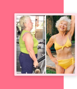 Joan macdonald before and after